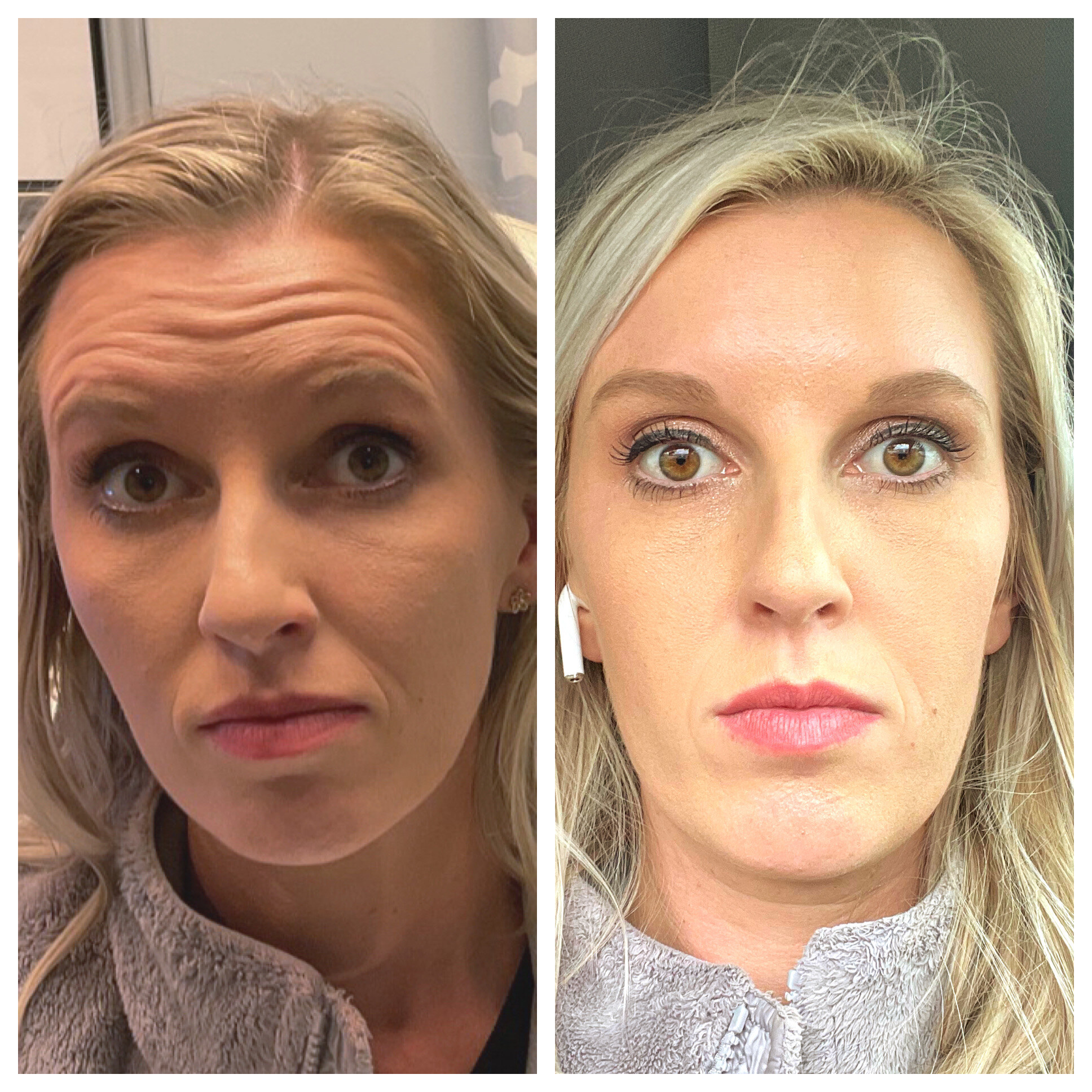 Injectables 3