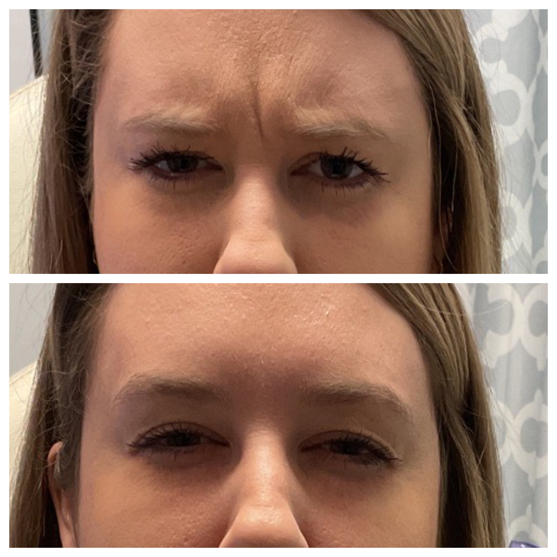 Injectables 1