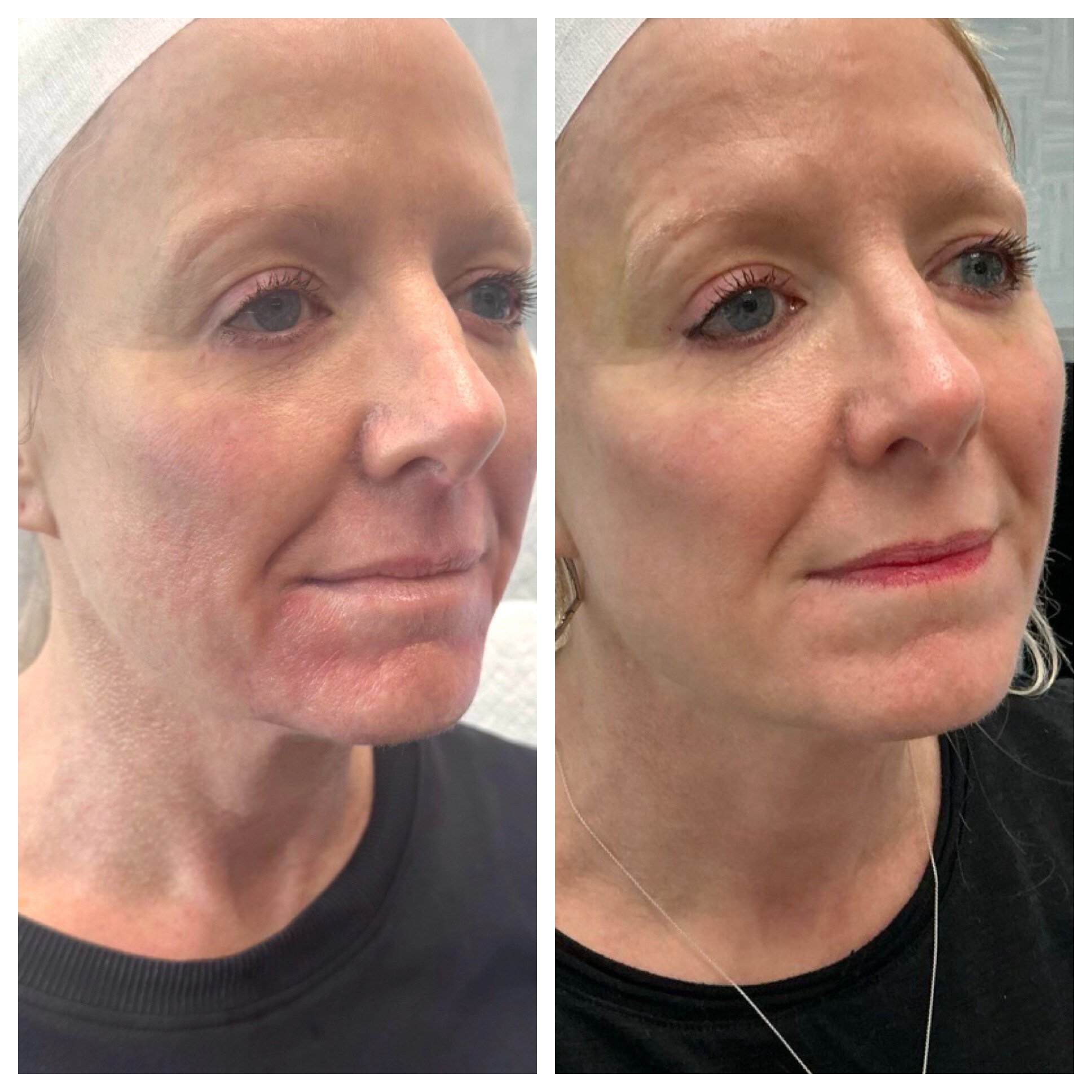 Attiva-2wks-post-1