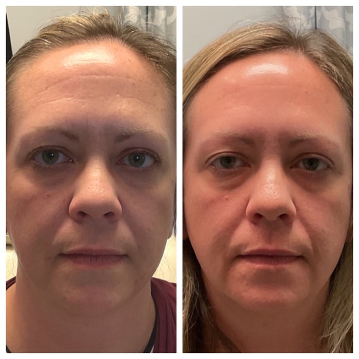 Skin-Care Progress