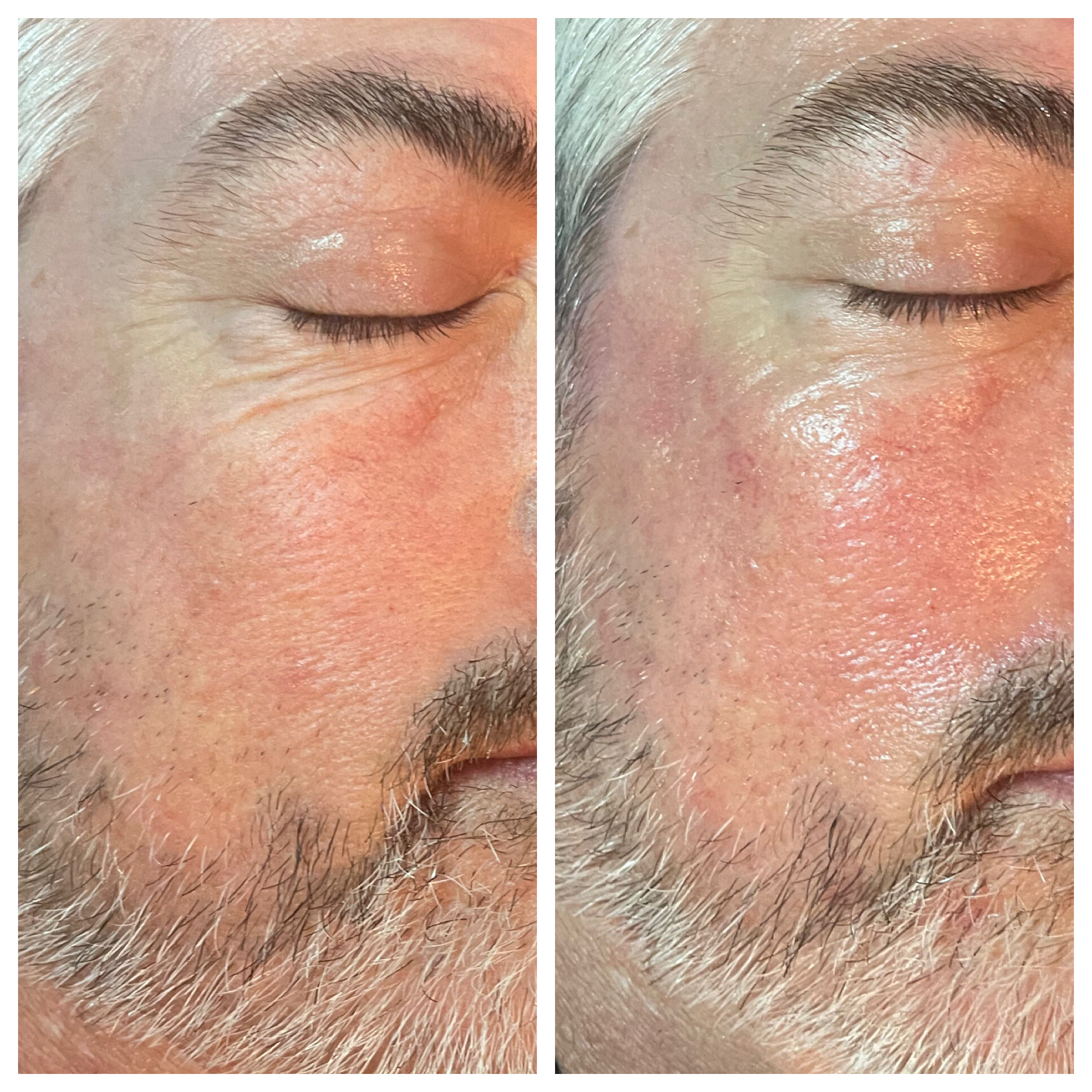 Skin Care 2