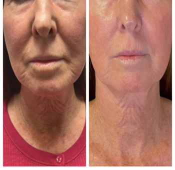 Skin Care 3