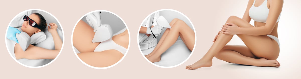 Laser Hair Removal treatment at St. Johns Aesthetics