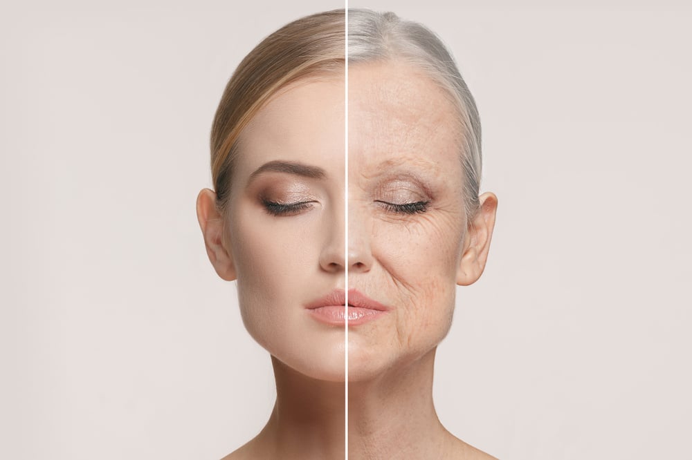 Attiva RF treatment at St. Johns Aesthetics