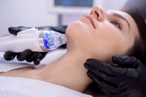 RF Microneedling ~ St Johns Aesthetics