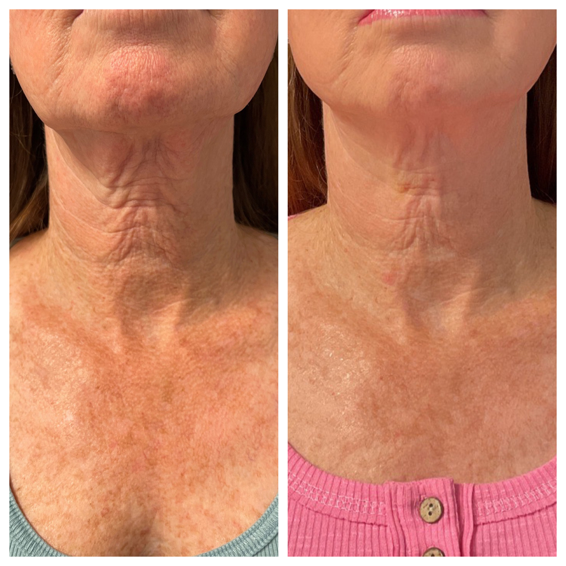 pdo-threads-sjawc-neck